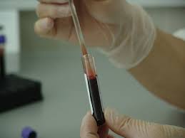 Analyses biochimiques