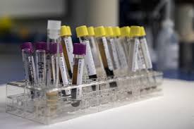 Tubes de prélèvements - Analyses biochimiques